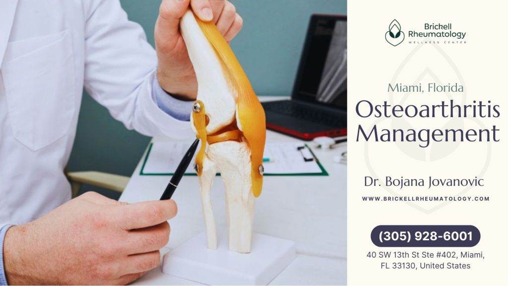 Osteoarthritis Management 3 A medical practitioner in a white coat demonstrates osteoarthritis management using a detailed anatomical model of a knee joint. The doctor is pointing at specific joint structures with a pen, likely explaining cartilage wear and tear or treatment options.