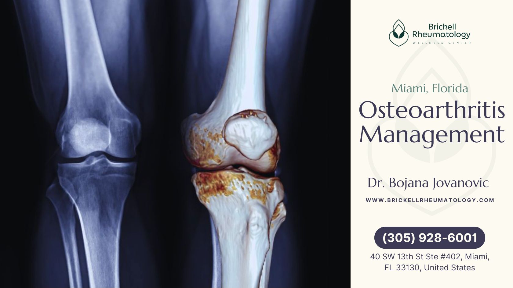 Osteoarthritis Management 1 The image compares a healthy knee joint and one with osteoarthritis. The left shows a standard X-ray of a normal joint, while the right presents a 3D scan highlighting cartilage loss, joint space narrowing, and bone spurs—clear signs of osteoarthritis-related wear and inflammation.