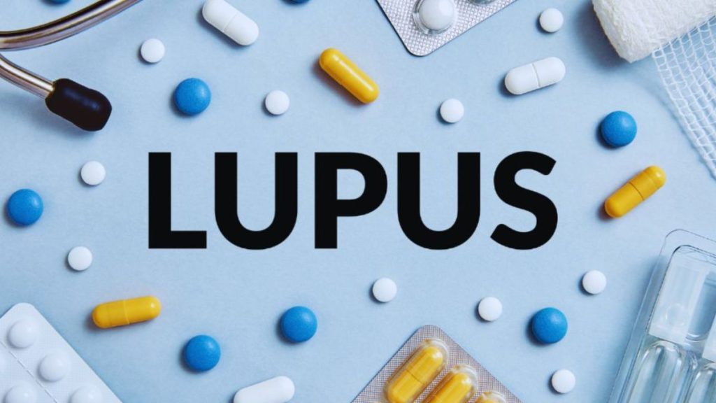 Lupus treatment concept with various medications, including Nonsteroidal Anti-Inflammatory Drugs (NSAIDs), capsules, tablets, and medical supplies, arranged around the word 'LUPUS' on a blue background.