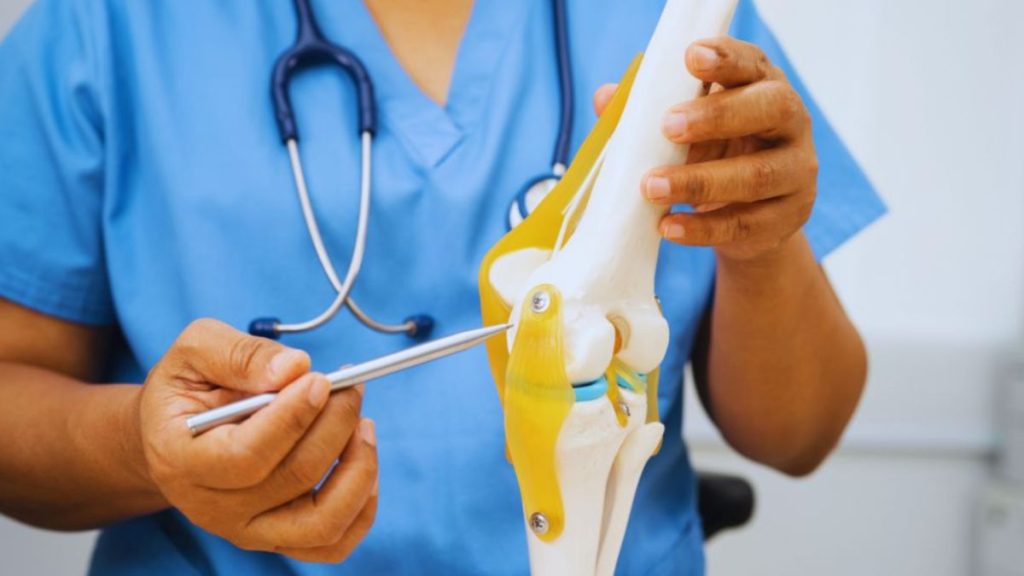 Osteoarthritis Management: How Can Physical Therapy Help? 3 Medical professional explaining osteoarthritis with an anatomical knee joint model.