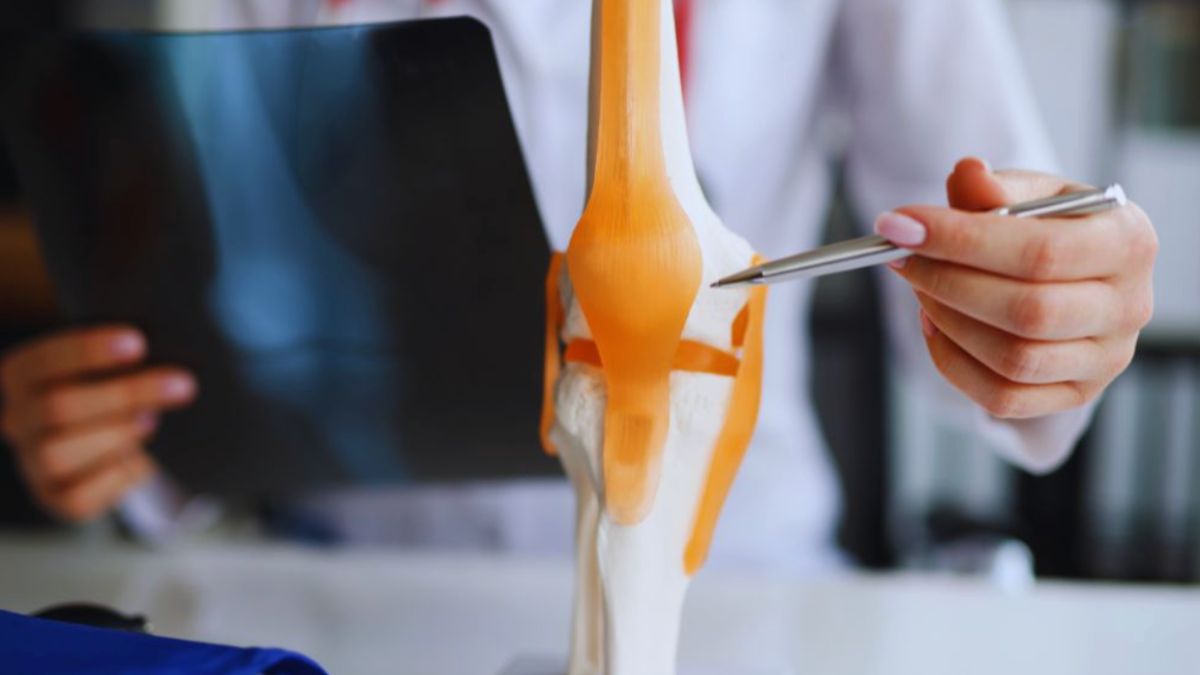 Doctor pointing at a knee joint model with ligaments highlighted while holding an X-ray, representing holistic rheumatology care for joint health.