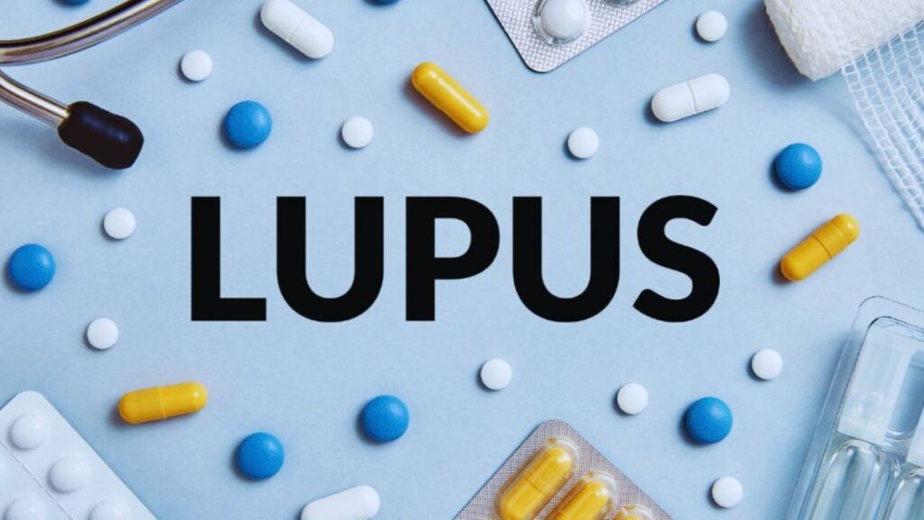Assorted lupus medications and supplies arranged around the word “LUPUS” on a blue background.