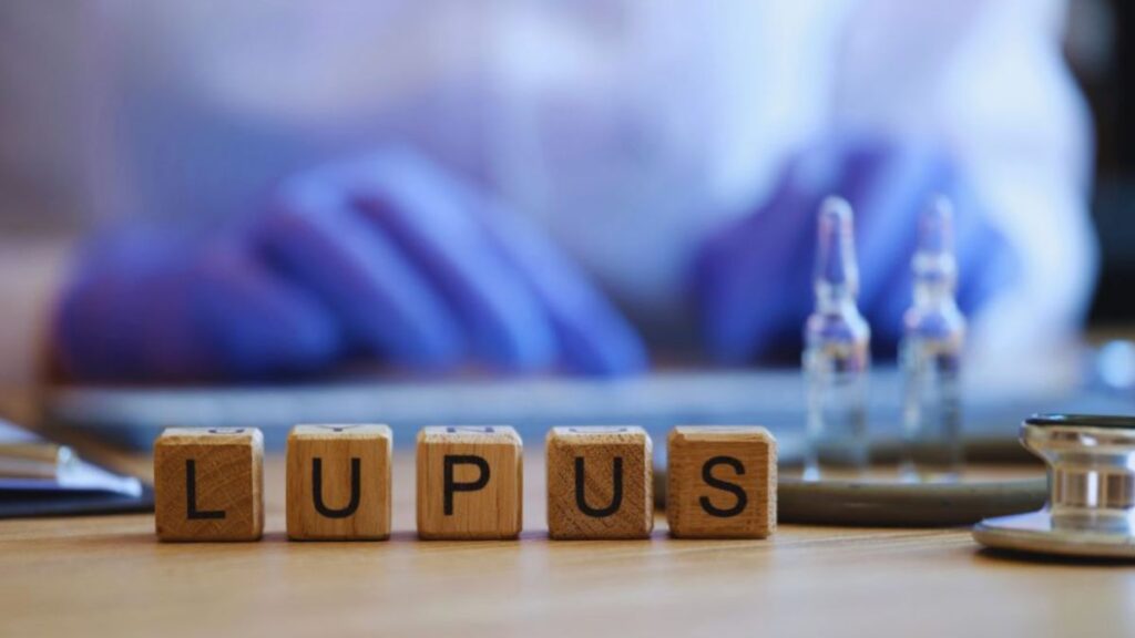 Lupus Medication Side Effects: What You Should Know 3 Brickell Rheumatology Lupus Medication Side Effects What You Should Know 2 | Brickell Rheumatology Wellness Center