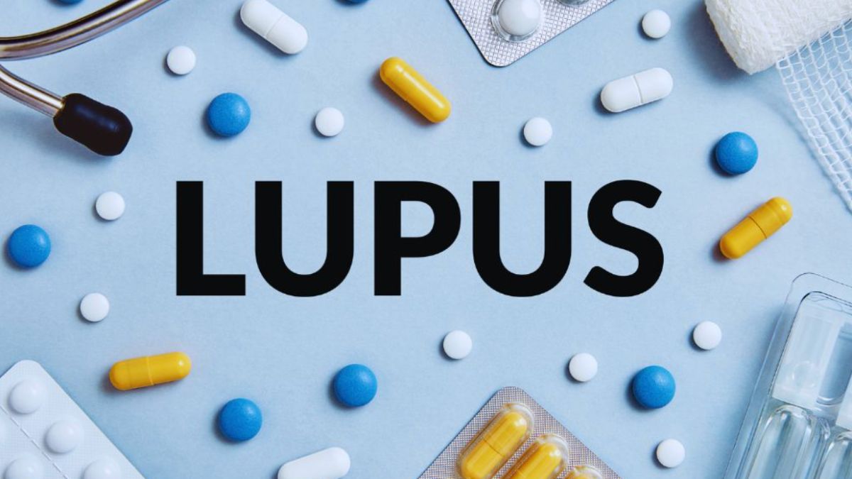 Assorted lupus medications and supplies arranged around the word “LUPUS” on a blue background.