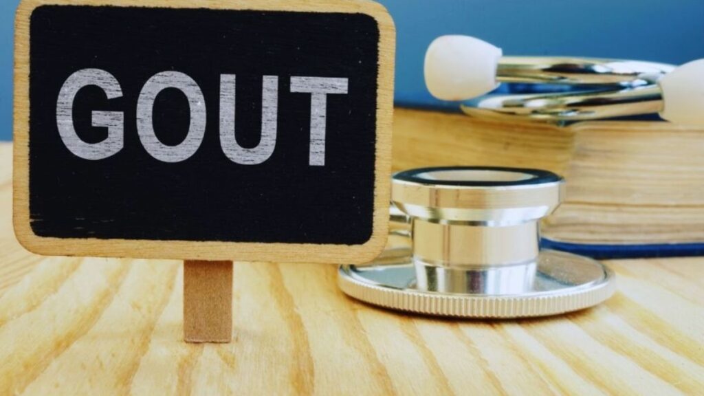 Medical illustration depicting gout caused by elevated uric acid levels, shown alongside related concepts in autoimmune disease care. The graphic supports educational content on symptom overlap and dietary management.