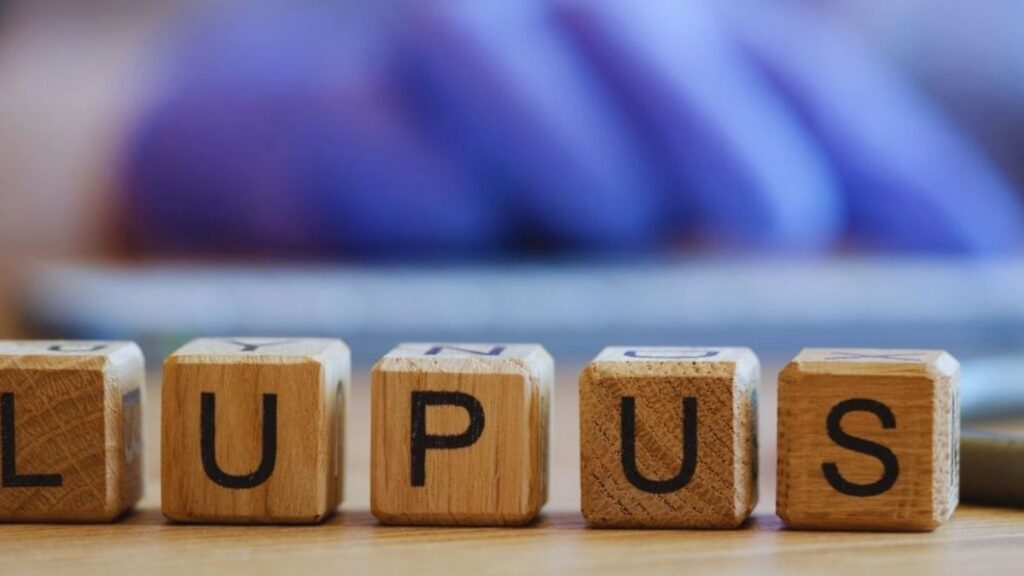 Lupus Treatment in Brickell concept image showing wooden letter blocks spelling “LUPUS” on a table, with medical gloves in the background, representing diagnosis, care, and clinical management of lupus.